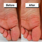 Pedicuure™: Automatic Callus Remover